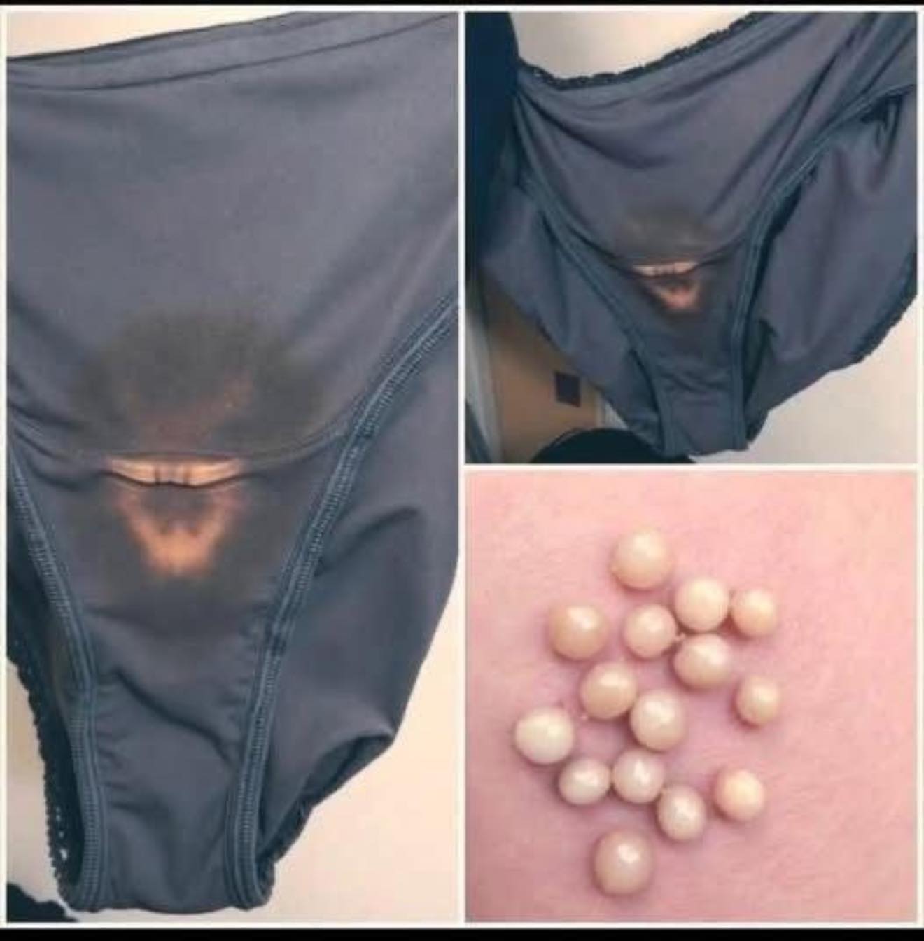 BE CAREFUL, if you notice this in your underwear, it means you have