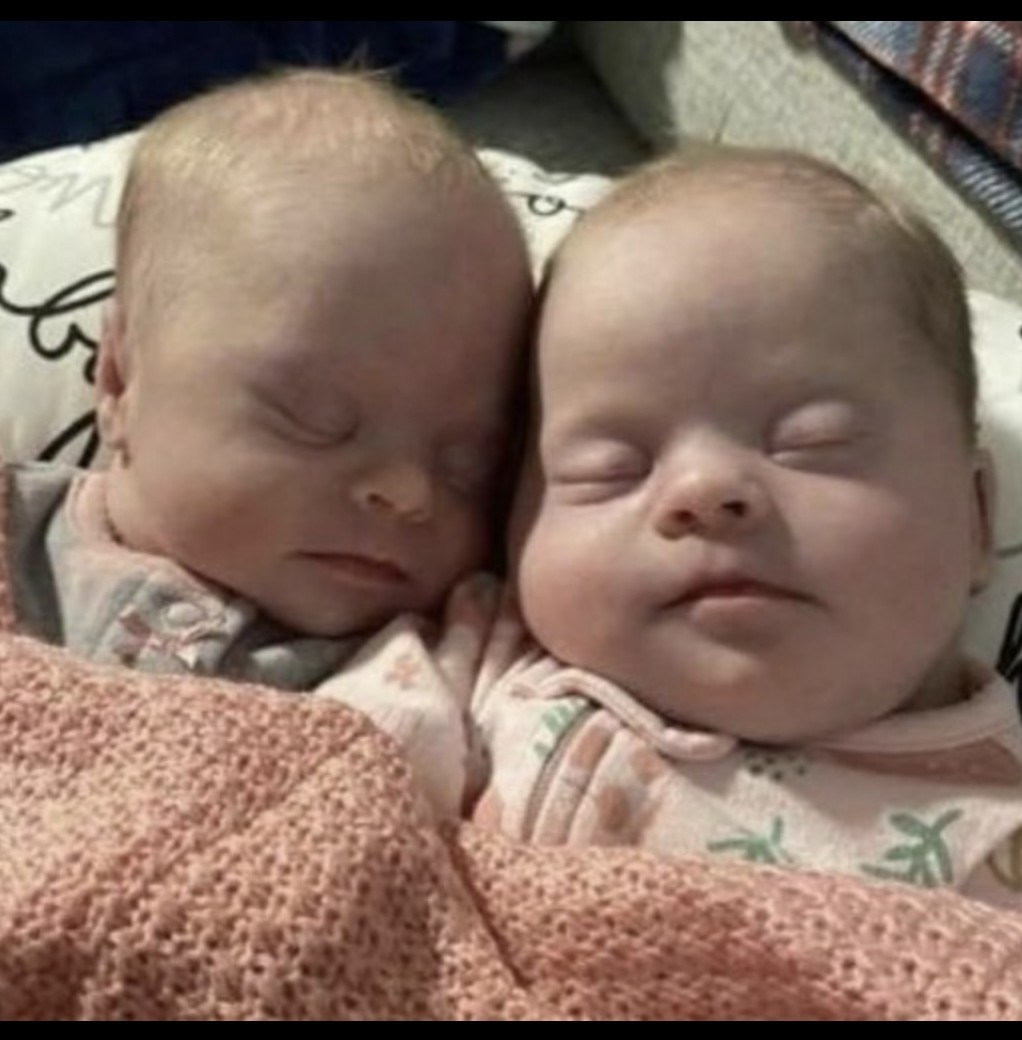 Mom of rare twins with D own s yndrome